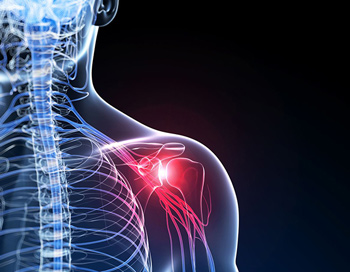 Preventing Shoulder Pain